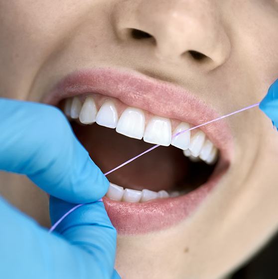 Close-up of dentist flossing patient’s teeth
