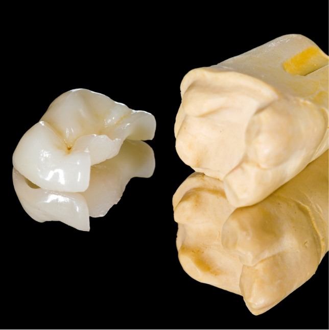 Model tooth and cosmetic dental bonding material