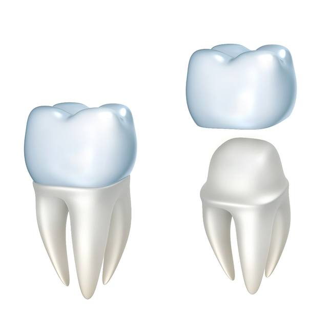 Two dental crowns