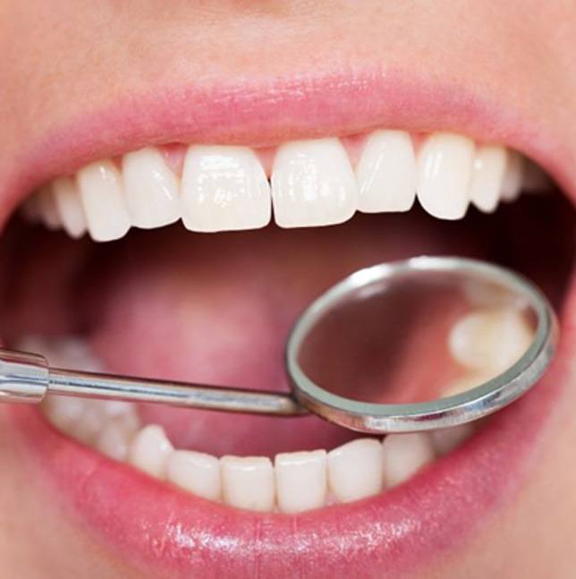 Dental mirror showing filling in patient’s mouth