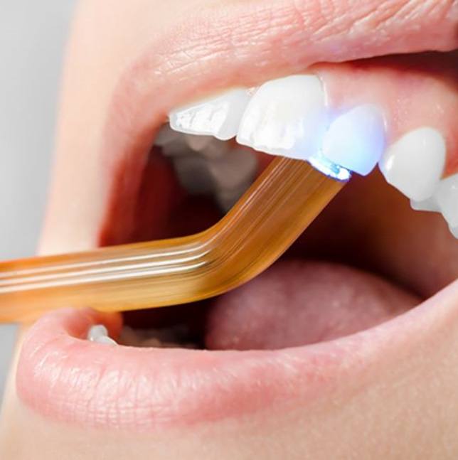 Curing light being used to harden tooth-colored filling