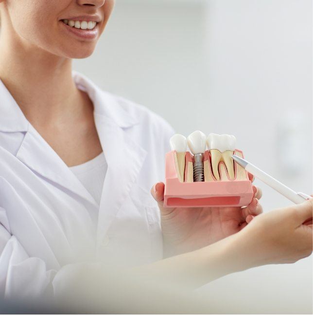 Dentist holding model of dental implant