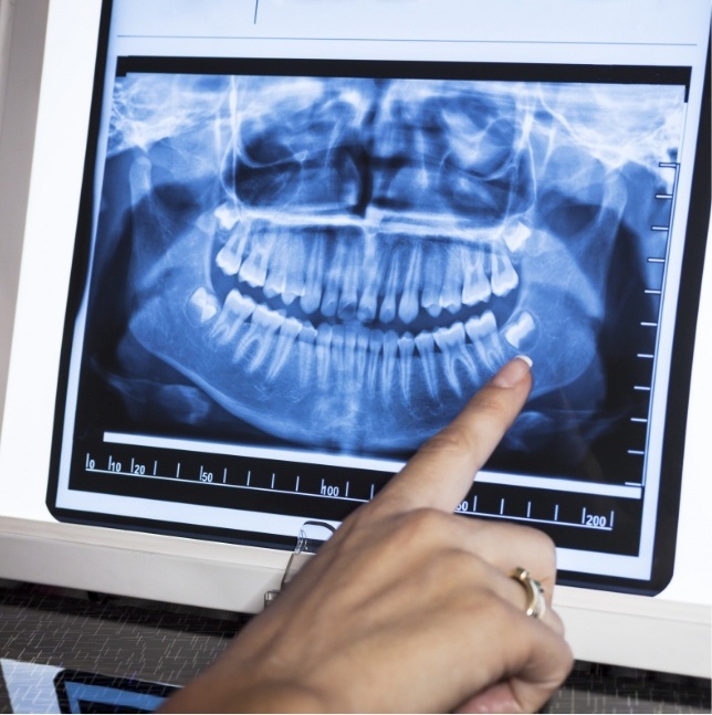 X rays of teeth on chairside computer screen